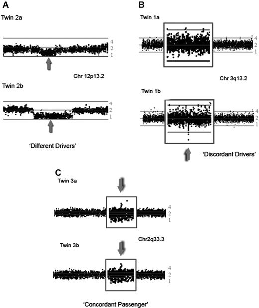 Figure 1. SNP array plots of CNAs detected in the leukemic bone marrow of twins with concordant ETV6-RUNX1 fusion gene positive ALL. The ratio of loss of heterozygosity of the leukemic versus the matched remission sample is plotted on a logarithmic scale to estimate the copy number. Each dot represents the log2 ratio of 1 SNP, with a moving average of 3 SNPs. The middle line represents a copy number of 2, the lower line a copy number of 1, and the top a copy number of 4. (A) 250K Sty SNP array analysis showing the short arm of chromosome 12 of twin set 2. Both twins have a deletion of 12p13.2, including the ETV6 gene (gray arrow); however, the boundaries and size of the deletion are different in each twin. (B) 250K Nsp plot of part of the long arm of chromosome 3 of twin set 1 showing a discordant deletion of 147 kb in region 3q13.2, which includes the BTLA and CD200 genes, seen in twin 1b, but not in twin 1a. (C) 250K Sty plot of part of the long arm of chromosome 2 of twin set 3 showing an identical gain of a 208-kb region at 2q33.3.