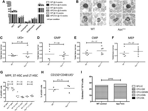 Figure 1. Apcmin mice have normal hematopoiesis at steady state. (A) Full blood count examination at 4, 8, and 12 weeks. (B) Peripheral blood morphology demonstrating lymphocytes (top) and neutrophils (bottom). (C) LKS+ (lineagelowcKithighSca-1+ enriched for hematopoietic stem cells) numbers as a percentage of total bone marrow cells. (D) GMP numbers. (E) CMP numbers. (F) MEP numbers. (G) Hematopoietic stem and progenitor cell numbers expressed as a percentage of LKS+ cells. Multipotent progenitors (MPP) LKS+CD34+Flk2+, short-term hematopoietic stem cells (ST-HSC) LKS+CD34+Flk2−, and long-term HSC (LT-HSC) LKS+CD34−Flk2−. (H) Long-term HSC, CD150+CD48−LKS+ expressed as a percentage of LKS+ cells. (I) Colony-forming ability of 104 bone marrow cells in cytokine-enriched methylcellulose (M3434; StemCell Technologies) and scored for colony (> 50 cells) number and morphology after 7 days. Megakaryocyte colonies (CFU-Mk), megakaryocyte-erythroid colonies (CFU-EMk), mixed multilineage colonies (CFU-GEMM), granulocyte-monocyte colonies (CFU-GM), and blast forming units-erythroid colonies (BFU-E). A total of n = 3 is shown for each condition.