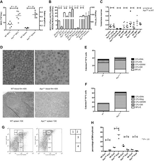 Figure 4. Aged Apcmin mice develop MDS/MPD. (A) White cell count (WCC × 103/μL) and spleen weight (mg) from Apcmin mice with MDS/MPD. WCC 19.2 × 103/μL Apcmin versus 7.4 × 103/μL WT, P < .01; neutrophil count 5.7 × 103/μL Apcmin versus 1.6 × 103/μL WT, P < .01; and spleen weight 0.69 g Apcmin versus 0.09 g WT, P < .01. (B) Peripheral blood parameters, including red cell count (RCC × 106/μL), hematocrit (HCT%), mean corpuscular volume (MCV fl), monocyte count (×103/μL), red cell distribution width (RDW%), and platelet count (×103/μL). Red cell count: 2.7 × 106/μL Apcmin versus 9.7 × 106/μL WT, P < .01; HCT: 17.4% Apcmin versus 42.8% WT, P < .01; MCV: 66.5 fl Apcmin versus 45 fl WT P < .01; monocyte count: 1.2 × 103/μL Apcmin versus 0.3 × 103/μL WT, P = .03; RDW: 23.7% Apcmin versus 17.3% WT, P < .01. (C) Hematopoietic stem and progenitor cell numbers expressed as a percentage of total bone marrow. LKS+ (lineagelowcKithighSca-1+ enriched for HSCs), LKS+SLAM (LKS+CD150+CD48− highly enriched for long-term HSC), GMPs, CMPs, and MEPs. (D) Peripheral blood films (magnification ×40) and splenic histology (magnification ×10) demonstrating macrocytic anemia with anisopoikilocytosis in Apcmin mice and effacement of normal splenic architecture by extramedullary hematopoiesis (images taken with Nikon Eclipse E400 microscope and digital camera; SPOT Diagnostic Instruments, model 2.2.1). (E) Colony-formation assays in cytokine-enriched methylcellulose from 104 bone marrow cells and (F) 105 spleen cells. Megakaryocyte colonies (CFU-Mk), megakaryocyte-erythroid colonies (CFU-EMk), mixed multilineage colonies (CFU-GEMM), granulocyte-monocyte colonies (CFU-GM), and blast forming units-erythroid colonies (BFU-E). Bone marrow: 41.5 Apcmin versus 36.8 colonies/104 cells WT, P = .35; BFU-E: 10.2 Apcmin versus 3.3 colonies/104 cells WT, P < .01; spleen: 84.2 Apcmin versus 35.8 colonies/105 cells WT, P < .01; CFU-GM: 58.8 Apcmin versus 30.8 colonies/105 cells WT, P < .01; BFU-E: 13.2 Apcmin versus 1.8 colonies/105 cells WT, P < .01). (G) Erythroid maturation flow cytometric analysis. Ery1 (CD71high, Ter119mid), Ery2 (CD71high, Ter119high), Ery3 (CD71mid, Ter119high), and Ery4 (CD71low, Ter119high). (H) Graphical representation of erythroid maturation demonstrating shift toward immature (Ery1/2) development. 2.5% and 34.8% Apcmin versus 0.2% and 8.0% WT for Ery1 and Ery2, respectively, P < .01; 3.1% and 0.6% Apcmin versus 11.4% and 3.2% WT for Ery3 and Ery4, respectively, P < .01.