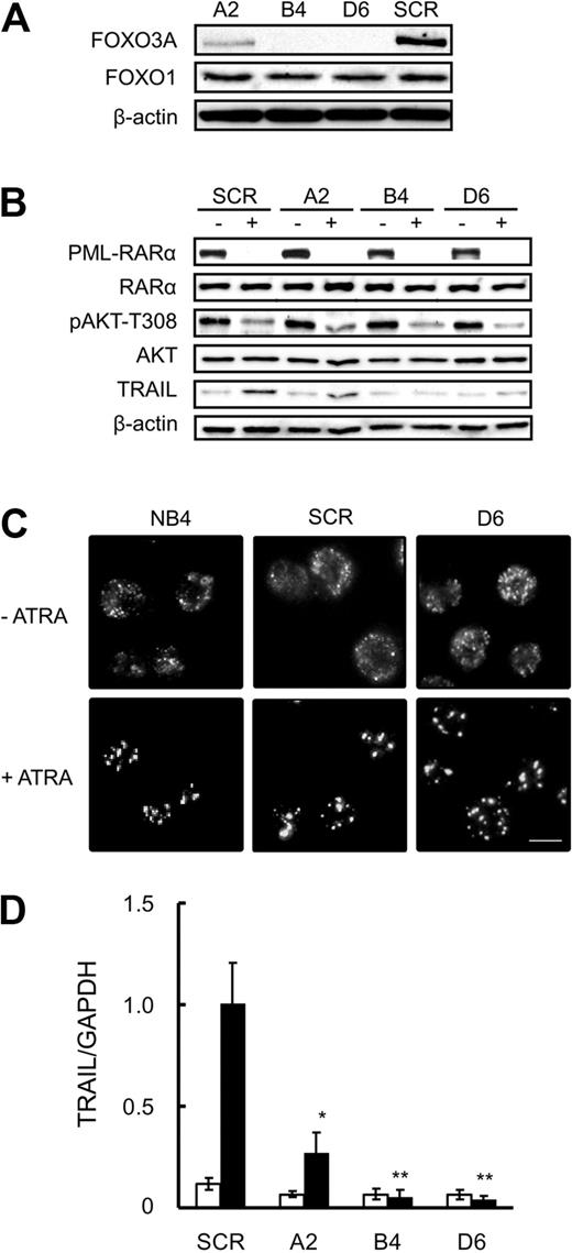 Figure 2. Knockdown of FOXO3A does not affect ATRA-induced PML-RARα degradation or subsequent formation of NBs in NB4 cells. (A) Total protein was extracted from SCR or FOXO3A shRNA clones cells and submitted to Western blotting with antibodies against the indicated antigens. β-Actin was used as an internal control. (B) SCR or FOXO3A shRNA clones cells were incubated with 1.0μM ATRA or a final volume of 0.1% ethanol for 48 hours. Total protein was extracted and submitted to Western blotting with antibodies against indicated the antigens. β-Actin was used as the internal control. (C) NB4, SCR, or FOXO3A shRNA clones were incubated with or without 1.0μM ATRA for 48 hours and fixed on poly-l-lysine–treated glass slides. After permeabilization, cells were incubated with anti-PML antibody and Alexa488-conjugated goat anti–mouse IgG. Imaging analysis was performed with an Olympus IX70 microscope. Scale bar represents 10 μm. (D) TRAIL mRNA was detected by quantitative RT-PCR using TaqMan probes for TRAIL and GAPDH. Quantification was performed using the relative standard curve method. ■ and □ represent 1.0μM ATRA and 0.1% ethanol, respectively. Results are the mean ± SE of 3 independent experiments. *P < .05 and **P < .01 compared with the SCR control.