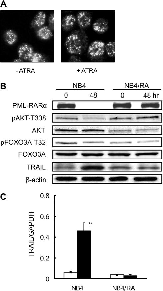Figure 4. ATRA does not affect PML-RARα degradation or the dephosphorylation of FOXO3A in ATRA-resistant NB4/RA cells. NB4/RA cells were incubated with 1.0μM ATRA or a final volume of 0.1% ethanol for 48 hours. (A) Cells were fixed on poly-l-lysine–treated glass slides. After permeabilization, cells were incubated with anti-PML antibody and with Alexa488-conjugated goat anti–mouse IgG. Imaging analysis was performed with an Olympus IX70 microscope. Scale bar represents 10μm. (B) Total protein was extracted and submitted to Western blotting with antibodies for each indicated antigen. (C) TRAIL mRNA was detected by quantitative RT-PCR using TaqMan probes for TRAIL and GAPDH. Quantification was performed using the relative standard curve method. Results are presented as the mean ± SE of 3 independent experiments. **P < .01 compared with ethanol control.