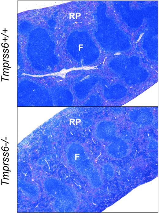 Figure 2. Tmprss6−/− mice show increased extramedullary hematopoiesis. Giemsa-stained histologic sections of spleens from Tmprss6+/+ (top) and Tmprss6−/− (bottom) mice. RP indicates splenic red pulp; and F, lymphoid follicle. Original magnification ×40.