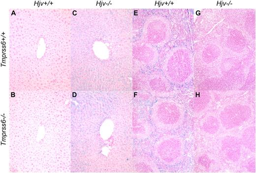 Figure 4. Tmprss6−/−Hjv−/− and Tmprss6+/+Hjv−/− mice show similar iron distribution in liver and spleen. Perls Prussian blue staining of histologic sections of liver (A-D) and spleen (E-H). Blue staining represents iron accumulation in cells. Tmprss6+/+Hjv+/+ (A) and Tmprss6−/−Hjv+/+ (B) mice lack histologic evidence of excess iron deposition, whereas Tmprss6+/+Hjv−/− (C) and Tmprss6−/−Hjv−/− (D) mice show marked iron accumulation in hepatocytes. Splenic macrophages of Tmprss6+/+Hjv+/+ (E) and Tmprss6−/−Hjv+/+ (F) mice show abundant iron, whereas minimal iron is detected in splenic macrophages of Tmprss6+/+Hjv−/− (G) and Tmprss6−/−Hjv−/− (H) mice. Original magnification ×200 (A-D) and ×100 (E-H).