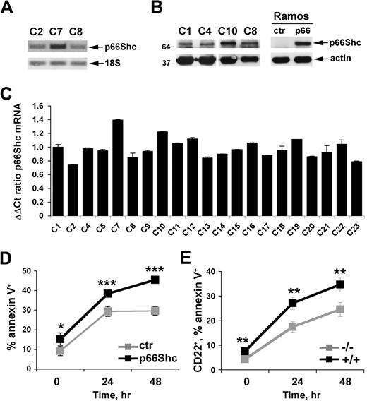 Figure 1. p66Shc acts as a negative regulator of B-cell survival. (A) Detection of p66Shc-specific mRNA in peripheral blood B cells purified from healthy donors by semiquantitative RT-PCR. The identity of the band was confirmed by automated sequencing. (B) Immunoblot analysis of p66Shc expression in lysates of peripheral blood B cells purified from 4 representative healthy donors. Lysates of Ramos B cells stably transfected with either empty vector (ctr) or the same vector encoding human p66Shc (p66) are shown on the right. Stripped filters were reprobed with anti-actin antibodies as loading control. (C) Quantification by real-time RT-PCR of the levels of p66Shc mRNA in peripheral blood B cells purified from 21 healthy donors. Transcript levels were normalized to the expression level of GAPDH. For each donor, Syber green runs were performed on duplicate samples of cDNAs from 2 independent reverse transcription reactions, each carried out on 400 ng of total RNA. RNA from the same healthy donor (C1) was included in duplicate in each run as reference to normalize the data obtained in the individual experiments. The ΔΔCT method was applied as a comparative method of quantification, using as a reference the average of all the Ct data obtained on donor C1. The histograms show the mean ± SD of the 4 reactions carried out for each RNA. Statistical analysis (Student t test) did not show any significant difference in p66Shc mRNA levels among healthy donors. (D) Flow cytometric analysis of annexin V staining on Ramos B cells stably transfected with either empty vector (ctr) or the same vector encoding human p66Shc (p66), activated for 24 and 48 hours with anti-IgM antibodies. The graph shows the percentage (mean value ± SD) of annexin V+ cells (n = 3). (E) Flow cytometric analysis of annexin V staining of splenocytes from control (+/+) or p66Shc−/− (−/−) mice activated for 24 and 48 hours with goat IgG fraction specific for mouse immunoglobulins (40 μg/mL). The analysis was carried out on gated CD22+ cells. The graph shows the percentage (mean value ± SD) of annexin V+ splenocytes (n = 4; ***P ≤ .001, **P ≤ .01, *P ≤ .05).