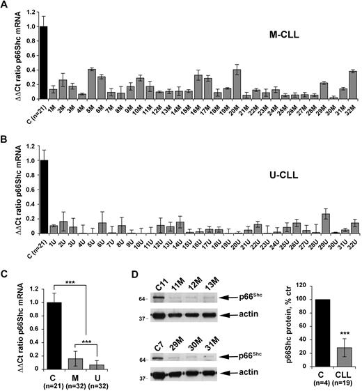 Figure 3. Defective p66Shc expression in CLL B cells. Quantification by real-time RT-PCR of the levels of p66Shc mRNA in monocyte-depleted peripheral blood mononuclear cells (B cells ≥ 85%, as assessed by flow cytometry) purified by density gradient centrifugation from 64 patients with CLL, of which 32 with mutated IGHV (M-CLL; A) and 32 with unmutated IGHV (U-CLL; B). Transcript levels were normalized to the expression level of GAPDH. For each patient, Sybr green runs were performed on duplicate samples of cDNAs from 2 independent reverse transcription reactions, each carried out on 400 ng of total RNA. RNA from the same healthy donor (C1) was included in duplicate in each run as reference to normalize the data obtained in the individual experiments. The ΔΔCT method was applied as a comparative method of quantification, using as a reference the average of all the Ct data obtained on healthy donors. (C) Histograms summarizing the real-time RT-PCR analysis of p66Shc mRNA levels in B cells from the 21 healthy donors and 64 patients with CLL shown in panels A and B, grouped in the M-CLL and U-CLL subsets (***P ≤ .001). Error bars indicate SD. (D) Immunoblot analysis of p66Shc expression in lysates of monocyte-depleted peripheral blood mononuclear cells purified by density gradient centrifugation from 4 representative patients with CLL and 1 representative healthy donor. Stripped filters were reprobed with anti-actin antibodies as loading control. The histogram on the right of the panel shows the quantification by laser densitometry of p66Shc immunoreactive band in lysates of PBLs from 19 patients with CLL compared with lysates of peripheral blood B cells purified from 4 healthy donors by immunomagnetic sorting, of which at least 1 was included in each gel as reference (***P ≤ .001).