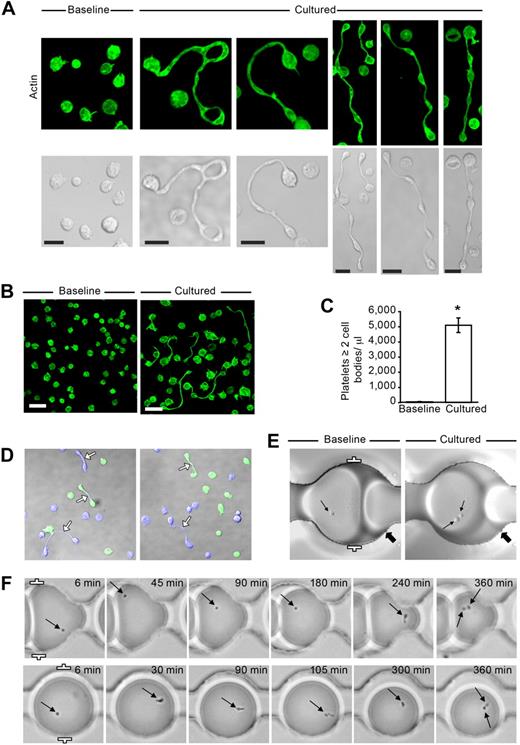 Figure 1. Freshly isolated platelets extend projections with distinct cell bodies. (A) Localization of actin (green, phalloidin) in human platelets that were fixed immediately after isolation (Baseline) or after 6 hours in suspension (Cultured). The bottom row displays corresponding transmission images. This figure is representative of more than 20 independent experiments. Scale bars represent 5 μm. (B) Lower magnification of freshly isolated platelets that were stained for actin at baseline or after they were cultured for 6 hours (scale bars, 10 μm). Panel is representative of more than 20 experiments. (C) The bar graph indicates the number of extended platelets with at least 2 cell bodies per microliter of culture media (mean ± SEM; n = 13). *P < .05, baseline versus cultured. (D) Two separate cultures of platelets were labeled (blue or green) and then incubated with one another for 6 hours. Left and right panels: 2 independent experiments, which are representative of 3. (E) Platelets were loaded into “parked” microdrops and examined at baseline or after 6 hours (Cultured). The thin arrows point to single platelets (Baseline) or the same platelet that formed 2 distinct cell bodies after 6 hours (Cultured). The thick arrows point to unique landmarks for each position in the microfluidic device. (F) Sequential images of platelets using low-resolution wide-field microscopy. The arrows highlight the location of the platelets within each drop during the course of the experiment and the formation of 2 distinct cell bodies after 6 hours (far right panels). Distance between the white brackets (E-F, far left panels) is 50 μm.