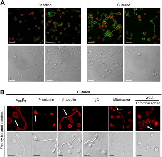 Figure 2. Platelets develop new cell bodies in whole blood and express critical biomarkers. (A) Platelets were isolated from freshly collected (Baseline) or cultured (6 hours) whole blood as described in “Platelet isolation and culture.” The red and green stains identify sialic acids (WGA) and β-tubulin, respectively. (B) Freshly isolated platelets were cultured (6 hours) alone or in the presence (far right panels) of thrombin (0.01 U/mL). From left to right in the top row, the red stain identifies αIIbβ3, P-selectin, β-tubulin, control IgG, respiring mitochondria (Mitotracker), or sialic acids. Corresponding transmission images are shown in the bottom row. Scale bars represent 5 μm. Panels A and B are representative of 3 independent experiments.