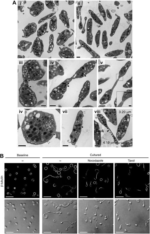 Figure 3. Newly formed platelets possess granules and an elaborate microtubule network. (A) Thin section TEMs of representative platelets at baseline (i,vi,vii) and after 6 hours in culture (ii-v,viii). The black scale bar represents 500 nm. Multiple α granules (black arrows) are observed in platelets with multiple cell bodies (iii-v) and occasionally in the connecting region (iii). A constricted region resembling a cleavage furrow is noted along the long shaft of a cultured platelet (v with inset, original magnification ×80 000; scale bar represents 100 nm). Original magnifications: iii, ×25 000; iv-v, ×30 000. Microtubules in cross section were also observed at ends of the cultured platelets (viii white arrows). (viii) How platelet diameters were measured by TEM (original magnification ×30 000), which confirmed that cell diameters significantly (P < .05) increased in cultured platelets compared with freshly isolated platelets (also see Figure 5Ai). (B) The panels display baseline platelets (far left) and cultured platelets (6 hours) that were left alone or treated with reagents that disrupt microtubular function (ie, nocodazole or taxol). Top row: Specific immunostaining for β-tubulin. Bottom row: Corresponding transmission images. This figure is representative of 3 independent experiments. Scale bars represent 10 μm.