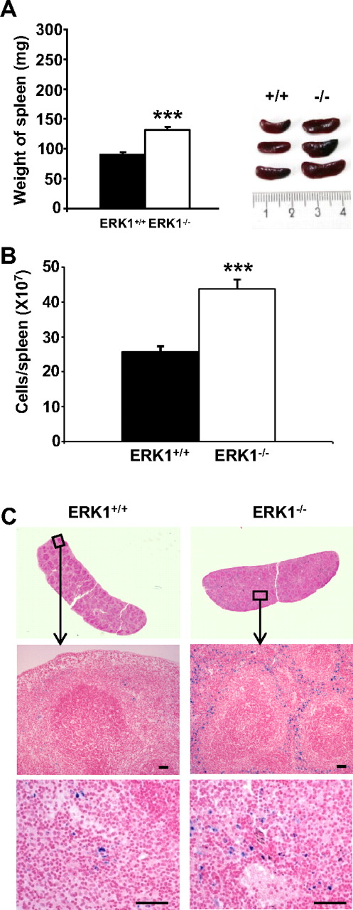 Figure 1. Analysis of ERK1−/−-induced splenomegaly. (A) Age- and sex-matched ERK1−/− (□) and ERK1+/+ (■) mice at 2 to 4 months of age were killed, and spleen lengths and weights were measured. A representative comparison of ERK1+/+ and ERK1−/− spleens is shown in the inset (ruler increments are in millimeters). Data are means ± SEMs, n = 14 for ERK1+/+ and for ERK1−/− mice. (B) Splenocytes from ERK1+/+ and ERK1−/− mice at 2 to 4 months of age were counted on a hemocytometer. Data are means ± SEMs (n = 10) of cell number per spleen. (C) Perl Prussian blue staining for ferric iron in the spleen of 2-month-old ERK1+/+ and ERK1−/− mice (middle, original magnification ×100, with 10×/0.5 NA objective; bottom, original magnification ×200, with 20×/0.5 NA objective). Scale bars are for 50 μm. ***Significant differences between genotypes with P < .001.