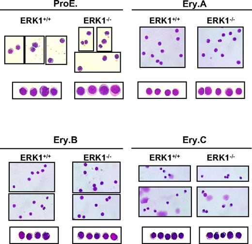 Figure 4. Similar spleen erythroblast maturation between ERK1+/+ and ERK1−/− mice. May-Grünwald-Giemsa–stained cytospin preparations of sorted ProE, Ery.A, Ery.B, and Ery.C subsets. Representative fields of cells are shown for each region. The photographs were taken at an original magnification of ×400 with a Leica DXC 950P microscope and TRiBVN ICS image-acquisition software.
