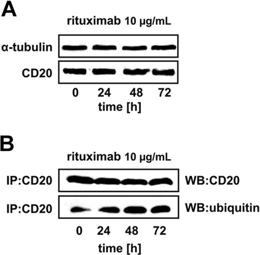 Figure 1. Rituximab binding increases CD20 ubiquitination. (A) Raji cells were seeded into the 25-cm2 bottles at a concentration of 5 × 105 cells/10 mL and exposed to 10 μg/mL rituximab for 24, 48, or 72 hours, after which protein lysates were prepared and analyzed in Western blotting. Each lane was loaded with 20 μg of total protein. Blots were sequentially probed (after stripping) with antitubulin and anti-CD20 antibodies. (B) Raji cells were seeded into the 25-cm2 bottles at a concentration of 5 × 105 cells/10 mL. The cells were exposed to 10 μg/mL rituximab for 24, 48, or 72 hours, after which protein lysates were prepared. CD20 antigen was immunoprecipitated from samples with protein G bead slurry and subjected to Western blot analysis. Blots were sequentially probed (after stripping) with antiubiquitin and anti-CD20 antibodies.