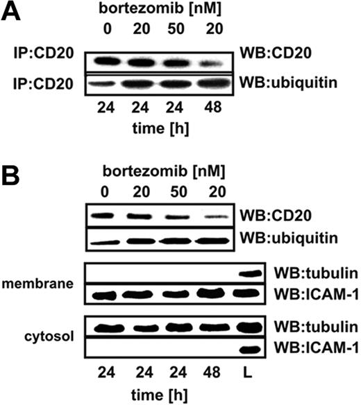 Figure 6. Proteasome inhibition increases ubiquitination of CD20. (A) Raji cells were seeded into the flask bottles at a concentration of 2 × 106 cells/10 mL. The cells were exposed to bortezomib at indicated concentrations for 24 or 48 hours, after which protein lysates were prepared. CD20 antigen was immunoprecipitated from samples with protein G bead slurry and subjected to Western blot analysis. Blots were sequentially probed (after stripping) with antiubiquitin and anti-CD20 antibodies. IP indicates immunoprecipitation; WB, Western blotting. (B) To assess the ubiquitination of membrane CD20, Raji cells were seeded into the flask bottles at a concentration of 2 × 106 cells/10 mL. The cells were exposed to bortezomib at indicated concentrations for 24 or 48 hours. Then, extracellular portions of membrane proteins were bound with EZ-link sulfo-NHS-biotin. Labeled cells were lysed and biotinylated proteins were precipitated with immobilized NeutrAvidin protein. Subsequently, from the mixture of boiled precipitated surface proteins, an additional immunoprecipitation step with anti-CD20 mAb (NCL-CD20-L26) was performed. Immunoprecipitates underwent electrophoresis followed by blotting with antiubiquitin and anti-CD20 antibodies. ICAM-1 is a marker for membrane fraction; and tubulin, for a cytosolic fraction. L indicates the total cell lysate that served as a positive control; WB, Western blotting.