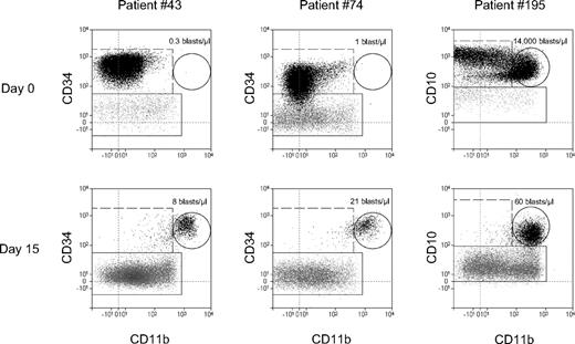 Figure 4. CD11b expression in ALL blasts under therapy: modulation vs selection. Comparison of absolute counts of CD11b+ blasts (the numbers of blasts/μL in the dot plots) at diagnosis and day 15. In the dot plots only CD19+ cells are depicted. Leukemic cells are shown as black dots and normal B cells as gray dots. Quantification of the CD11b+ leukemic cells (gated by solid-line circles) shows 2 cases of the therapy-induced CD11b up-regulation (left and middle). The right plots indicate selection of CD11b+ cells from initial 2 CD11b+ and CD11b− subpopulations of leukemic cells.