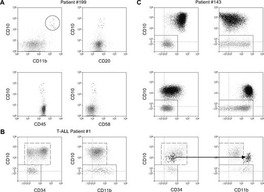 Figure 5. CD11b positivity improves discrimination between ALL and normal mature and precursor B cells. Flow cytometric dot plots depict CD19+ cells from BM of ALL patients. Leukemic cells are shown as black dots and normal B cells as gray dots. (A) D15 BM sample from a patient with ALL. CD11b in combination with CD10+ allows a reliable identification of the leukemia cells, which otherwise have a normal B-cell immunophenotype. (B) Analysis of the day-78 BM sample from a patient with T-cell ALL. The dot plot CD10 versus CD34 displays immunophenotypic pattern characteristic of normal CD19+ fraction within regenerating BM. The dot plot CD10 versus CD11b shows a very low CD11b expression in normal CD19+ hematogones. (C) The same, as in panel B, dot plot combinations for a patient with PBC-ALL at day 0 (top), day 33 (middle), and day 78 (bottom) of therapy. Note the consistently increased CD11b expression and a concomitant decrease of CD34 and CD10 expression in BM during the therapy. At day 78, the CD10 versus CD11b dot plot but not the CD10 versus CD34 plot clearly discriminates leukemic cells from normal regenerating cells.
