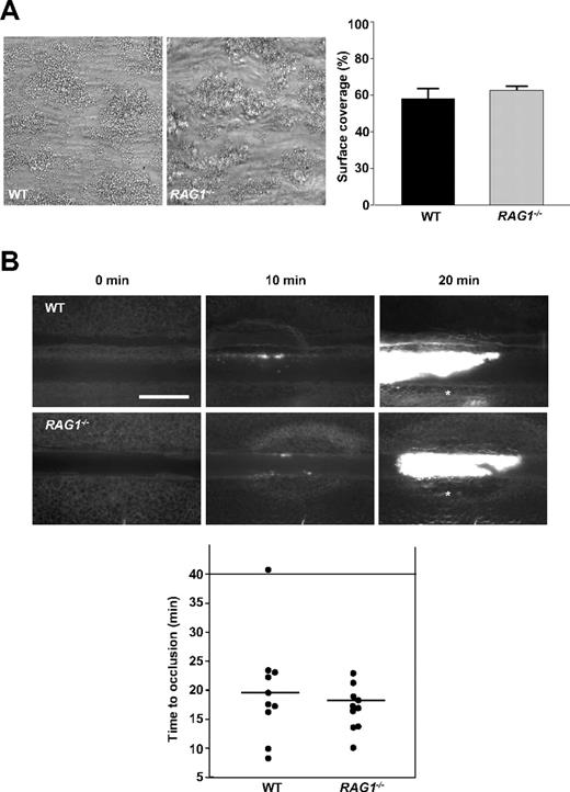 Figure 3. Thrombus formation in RAG1−/− mice is not affected in vitro and in vivo. (A) Platelets in whole blood from RAG1−/− mice form stable thrombi when perfused over a collagen-coated surface at a shear rate of 1000 s−1. Left panel shows representative phase-contrast images (40×/0.25 NA air objective). Right panel shows mean surface coverage by thrombi in RAG1−/− mice and WT controls (n = 5 per group). P > .05, 2-tailed Student t test compared with WT controls. (B) In vivo analysis of thrombus formation in RAG1−/− mice and WT controls (n = 10 per group). Mesenteric arterioles were treated with FeCl3 and adhesion, and thrombus formation of fluorescently labeled platelets were monitored by in vivo fluorescence microscopy. Representative images (top) and the time to vessel occlusion (bottom) are shown. Each symbol represents 1 animal, and horizontal bars depict means. The asterisk (top) indicates occlusion of the vessels. Scale bar equals 25 μm. P > .05, 2-tailed Student t test compared with WT control.