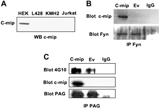 Figure 3. c-mip interacts with PAG and Fyn in HRS cell lines. (A) Western blot detection of c-mip protein in lysates from HRS and Jurkat cell lines. Human embryonic kidney (HEK) cells were transfected with a c-mip expression plasmid and were used as positive controls. Immunoprecipitation of endogenous Fyn (B) and PAG/Cbp (C) from HRS cell lines cotransfected with the c-mip expression plasmid or empty vector (Ev).