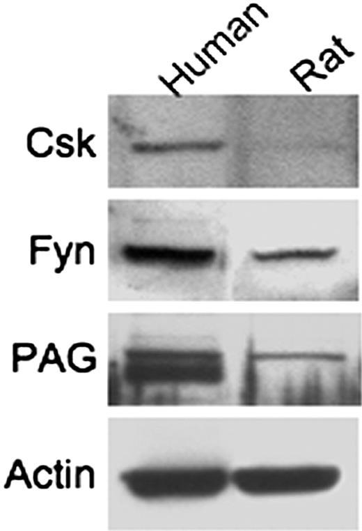 Figure 4. Expression of Fyn signaling regulatory loop in human and rat glomeruli. The presence of Csk, Fyn, and PAG was analyzed by Western blotting on glomerular extracts.