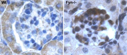 Figure 6. c-mip is up-regulated in Fyn-deficient mice. Immunohistochemistry analysis of c-mip in serial sections from normal and Fyn-deficient mice kidneys at an original magnification of ×40.