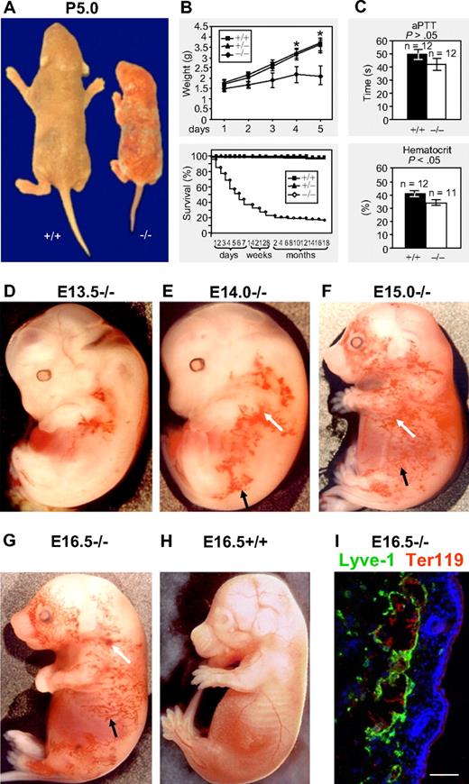 Figure 1. Macroscopic phenotype of podoplanin−/− mice in postnatal and embryonic development. (A-B) Podoplanin−/− mice in postnatal development are significantly smaller (right mouse) than podoplanin+/+ littermates (left mouse) or heterozygotes. Podoplanin−/− mice also show ectatic vessels and some bleeding in their skin. Approximately 20% of podoplanin−/− mice reach fertility age. (C) No significant differences between podoplanin−/− and podoplanin+/+ mice are detected in their activated partial thromboplastin time (aPTT), but a lower hematocrit is found in P5 podoplanin−/− mice. Values in panels B and C are means ± SD. (D-G) Blood-filled capillary network (black arrows) that increases in size with age, and blood extravasations (white arrows) are found in podoplanin−/−, but not in podoplanin+/+ embryos (H); Olympus SZ zoom stereo microscope, Sony DSC W200 camera with adapter VAE-WD. Immunofluorescence staining (I) identifies the dermal blood-filled vessels of podoplanin−/− embryos as Lyve-1+ lymphatics (green) that contain Ter119+ erythrocytes (red). Cell nuclei are stained with DAPI (blue); Olympus AX70, 20 ×/0.7 UPlanApo air objective. Scale bar in panel I equals 50 μm.