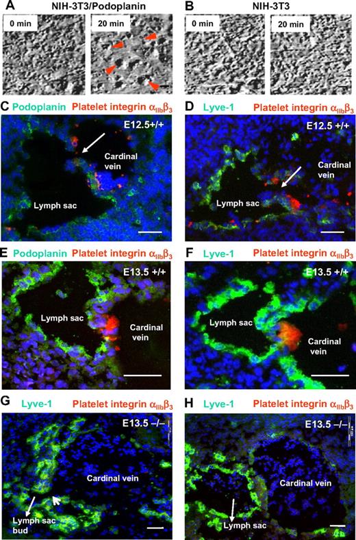 Figure 3. Platelet aggregation is driven by podoplanin and linked to separation of the lymph sacs from the cardinal veins. (A-B) Still frames of movies showing coincubation under flow conditions of isolated normal mouse platelets with monolayers of NIH-3T3 cells that transgenetically express podoplanin (A) or NIH-3T3 cells that were transfected with an empty vector (B). While large platelet aggregates form on the surfaces of podoplanin-expressing NIH-3T3 cells (red arrowheads), NIH-3T3 cells that lack podoplanin fail to interact with platelets even after 20 minutes. Imaged on an Olympus IX50 using a 40×/0.65 air LCAch (objective lens and a FViewII) camera (Olympus). (C-F) Direct demonstration in E12.5 and E13.5 podoplanin+/+ embryos of platelet thrombi (labeled for integrin αIIbβ3 in red) at the junction of cardinal veins and lymphatic sacs that are marked by podoplanin (green; C,E) or Lyve-1 (green; D,F). By contrast, platelets are absent from the lymph sac's orifice in E13.5 podoplanin−/− embryos (G-H) as seen on serial sections (220 μm apart) stained for Lyve-1 (green) and the platelet integrin αIIbβ3 (red). Note the still persisting connection (G) between lymph sac and vein. In the section 220 μm apart (H), the connection between lymph sac and cardinal vein is no longer visible; in panels G and H, erythrocytes/reticulocytes are present in the lymph sacs (Ter119 staining not shown). Cell nuclei are stained with DAPI (blue); Olympus AX70, 10×/0.40 air UPlanApo. Scale bars in panels A and B equal 10 μm; in panels C through H, 50 μm.