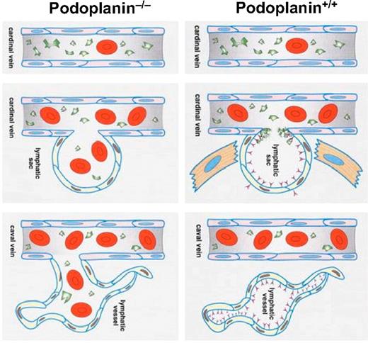 Figure 5. Schematic depiction of the mechanisms involved in separation of lymph sacs from the cardinal veins, resulting in the “separation phenotype” and “nonseparation phenotype.” The developmental default “separation” phenotype in podoplanin+/+ mice (right column) starts with formation of lymph sacs from the cardinal vein around E12. Endothelial cells of the lymph sacs acquire the lymphatic phenotype and express podoplanin (depicted by red “Y”-shaped objects) on their surface that binds and activates circulating platelets (depicted in green). Platelet thrombi develop around the orifice of the lymph sacs and lead to separation of the lymphatic sac from the cardinal vein either directly by an occluding platelet aggregate or indirectly by release of vasoconstrictive substances or growth factors released from activated platelets recruiting mural cells. At the stage of E14 and later, the separated lymph sacs are fully sequestered from the cardinal veins and sprout centrifugally to form a separate lymphatic circulatory system. The “nonseparation” phenotype in podoplanin−/− mice (left column) is characterized by persisting patent connections between the venous and the lymphatic systems. This is due to the absence of podoplanin on the lymphatic sac's endothelial cells, and thus the lack of local platelet activation and aggregation at the lymph sac's orifices. This results in blood perfusion of the outgrowing lymphatic vessels.