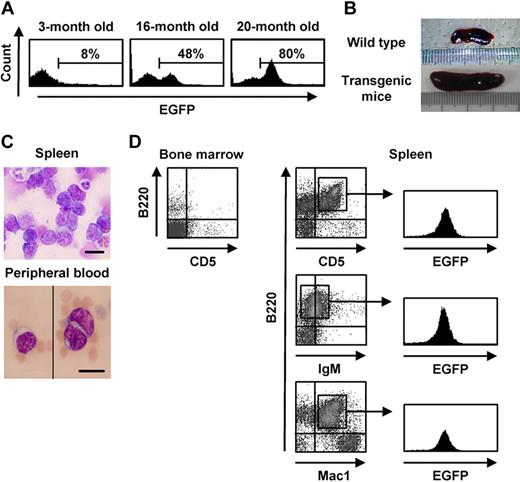 Figure 1. Hematologic analysis of the transgenic mice affected with B lymphoma. (A) EGFP expression in peripheral blood of a transgenic mouse affected with typical hematologic abnormalities at the indicated ages. (B) Spleens of 20-month-old wild-type and transgenic mice. (C-D) Morphologic appearance of spleen and peripheral blood cells (May-Gruenwald-Giemsa staining 63×/1.4 NA oil objective; C) and flow cytometric analysis of bone marrow and spleen cells (D) of transgenic mice exhibiting remarkable expansion of EGFP+ cells. Bars represent 10 μm in panel C.