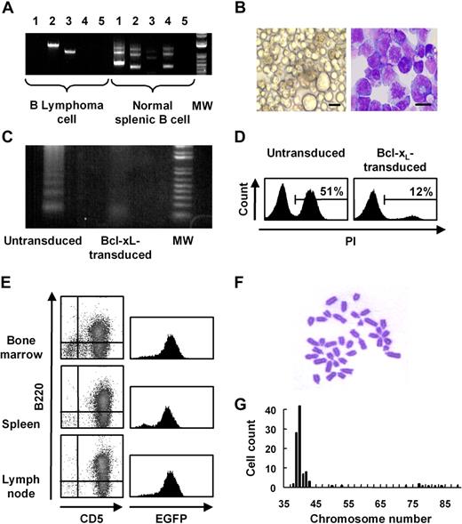 Figure 2. Characteristics of B-lymphoma cells generated from the transgenic mice. (A) PCR analysis of immunoglobulin gene rearrangement in splenic B cells of wild-type mice and B-lymphoma cells of transgenic mice. Lane 1 shows J558-JH4; lane 2, 7183-JH4; lane 3, Q52-JH4; lane 4, D-JH4; and lane 5, distilled water. (B) Morphologic appearance of B-lymphoma cells in vitro (left panel shows bright field in culture; right panel, May-Gruenwald-Giemsa staining of a cytospun sample; 63×/1.4 NA oil objective). Bars represent 10 μm. (C-D) Electrophoresis of genomic DNA (C) and propidium iodide staining (D) of untransduced or Bcl-xL–transduced B-lymphoma cells. (E) Flow cytometric analysis of marrow, spleen, and lymph node cells in NOD/SCID mice that underwent transplantation with B-lymphoma cells at 4 weeks after transplantation. (F) Karyotype analysis of the B-lymphoma cells by Giemsa staining (100×/1.4 NA oil objective). (G) The number of chromosomes of B-lymphoma cells. MW indicates molecular weight marker in panels A and C.