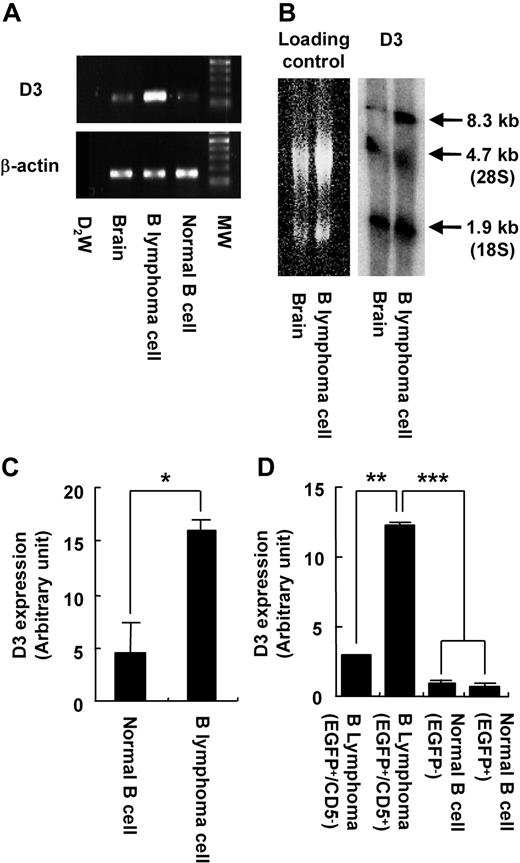 Figure 4. Activation of the D3 gene in the transgenic mice. (A) RT-PCR analysis of D3 expression in brain and splenic B cells of wild-type mice, and B-lymphoma cells of transgenic mice. β-actin is used as an internal control. MW indicates molecular weight marker. (B) Northern blotting of total RNA obtained from brain or B-lymphoma cells using a D3 probe. Left panel is shown as a loading control. D3 transcripts are found at the size of 8.3 kb in the right panel. 28S and 18S indicate ribosomal RNA. (C) Quantitative RT-PCR analysis of D3 expression in normal splenic B cells and B-lymphoma cells. (D) Quantitative RT-PCR analysis of D3 expression in B-lymphoma cells (CD5− or CD5+ in EGFP+ population) and normal B cells (EGFP− or EGFP+) in transgenic mice. Error bars are ± SD. *P < .05; **P < .01; ***P < .005 in panels C and D.