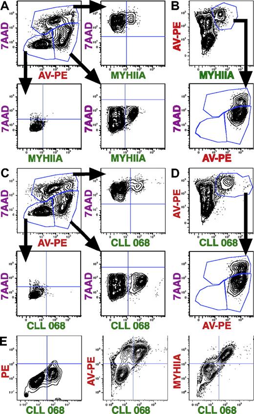 Figure 2. MYHIIA and CLL subset 6 mAb reactivity is exposed on a subset of early and late apoptotic cells. Flow cytometric analyses of spontaneous apoptotic Jurkat cells are displayed as contour plots of fluorescence intensity shown on 4-log scales with BiExponential transformation. (A) Cells were stained with rabbit anti–human MYHIIA antibody (100 μg/mL), FITC-conjugated anti–rabbit IgG (3 μg/mL), 7AAD, and AV-PE. Representatives of 9 experiments are shown. Early apoptotic cells (7AAD−, AV-PE+, 26.3%; top left panel) were gated and contain a subset of MYHIIA+ cells (22.9%; bottom right panel). Late apoptotic cells (7AAD+, AV-PE+, 14.5%; top left panel) were gated and contain a subset of MYHIIA+ cells (9.4%; top right panel). Gated live cells (7AAD−, AV-PE−, 58.5%; top left panel) contained no MYHIIA+ cells (0.4%; bottom left panel). (B) Same experiment as in panel A showing MYHIIA+ cells (7.3%) are all AV-PE+ (top panel). Gated MYHIIA+ cells are either early (78.9%) or late (19.9%) apoptotic cells (bottom panel). (C) Cells were stained with human CLL 068 mAb (100 μg/mL), FITC-conjugated anti–human IgG (2 μg/mL), 7AAD, and AV-PE. Representatives of 23 experiments are shown. Early apoptotic cells (23.7%; top left panel) were gated and contain a subset of CLL 068+ cells (27.3%; bottom right panel). Late apoptotic cells (23.0%; top left panel) were gated and contain a subset of CLL 068+ cells (8.3%; top right panel). Gated live cells (52.4%; top left panel) contained no CLL 068+ cells (0.1%; bottom left panel). (D) Same experiment as in panel C showing CLL 068+ cells (8.7%) are all AV-PE+ (top panel). Gated CLL 068+ cells are either early (73.6%) or late (24.8%) apoptotic cells (bottom panel). (E) Cells were stained with CLL 068 mAb (50 μg/mL) plus FITC-conjugated anti–human IgG (0.2 μg/mL; x-axis) and PE-conjugated anti–rabbit IgG alone (2.4 μg/mL), AV-PE, or anti-MYHIIA antibody (200 μg/mL) plus PE-conjugated anti–rabbit IgG (y-axis; left to right, respectively). Representatives of 19 experiments are shown. In this experiment, CLL mAb 068 reacts with 36.6% cells with less than 1% background PE staining (left panel). CLL 068 only stains AV-PE+ cells (44.1%), with a subset of AV-PE+ cells negative for CLL 068 staining (19.8%; middle panel). All CLL 068+ cells are MYHIIA+ (42.8%; right panel). Cells were not stained by secondary antibodies alone (not shown).