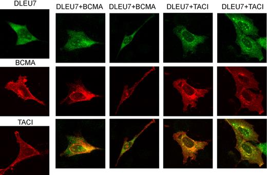 Figure 4. Intercellular localization of Dleu7, BCMA, and TACI. NIH-3T3 cells were transfected with DLEU7-HA, BCMA-Myc, and TACI-Myc constructs. After 16 hours, cells were fixed, permeabilized, and immunostained with rat anti-HA and mouse anti–c-Myc antibodies. Secondary goat anti–rat Alexa Fluor 488 and goat anti-mouse Alexa Fluor 546 antibodies were used to visualize intercellular localization of BCMA (red), TACI (red), and Dleu7 (green). Colocalization of BCMA and Dleu7 or TACI and Dleu7 is shown in yellow.