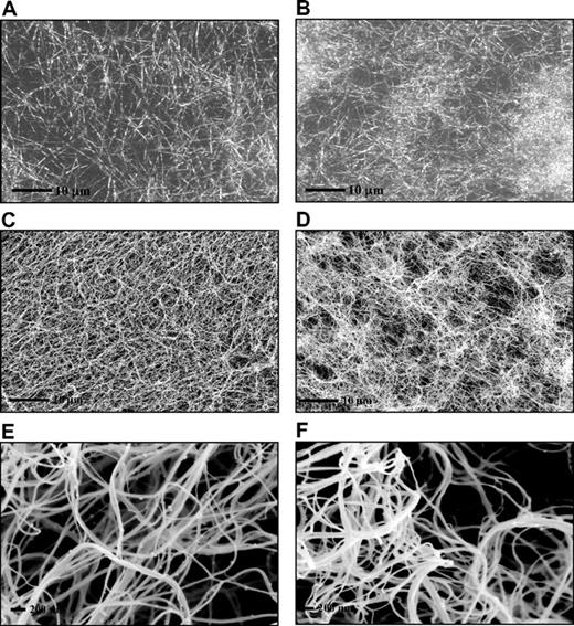 Figure 3. PolyP-induced changes in fibrin ultrastructure. Fibrin clots were prepared by incubating fibrinogen (3μM) with thrombin (0.25 U/mL) and CaCl2 (5mM) in the absence (A,C,E) and the presence (B,D,F) of polyP65 (325μM). Fibrin clots analyzed by laser scanning confocal microscopy (A-B) and were analyzed by scanning electron micrographs (C-F). A total of 10 different areas were visualized in 3 replicate clots, and representative pictures are shown. The high-magnification images (E-F) show details of a tightly knotted fibrin region in the presence of polyP (F).