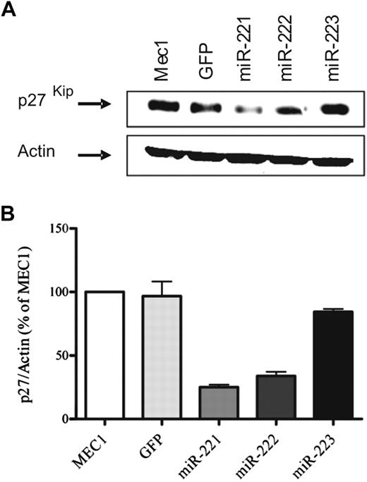 Figure 2. miR-221/222 transduction decreases p27 expression in MEC1 cells. Total cell lysate from parental MEC1 cells or MEC1 transduced with vectors encoding miR-221/222 and 223, as control, were subjected to Western blot analysis. Blots were stained with anti-p27 antibody and then stripped and reprobed with β-actin as loading control. A representative blot is shown (A). Densitometric analysis shows the entity of reduction in p27 expression. The average of 3 independent experiments is shown in the graph (mean + SD; B).
