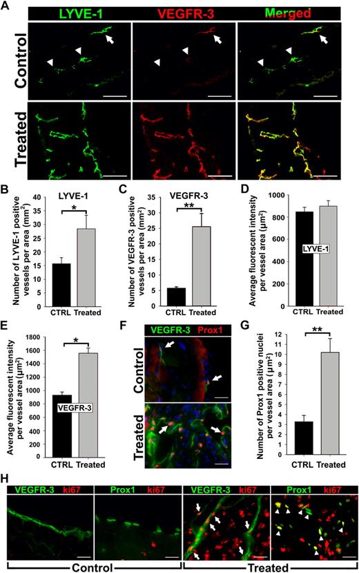 Figure 1. Inflammation induces VEGFR-3 and Prox1 expression in activated lymphatic vessels. Peritonitis was induced by repetitive intraperitoneal injections of thioglycollate (TG) every 48 hours for 2 weeks. (A) Diaphragms from mice treated for 2 weeks with TG to induce peritonitis or saline as a control (n = 3 mice per group) were double-stained with anti–LYVE-1 and anti–VEGFR-3 antibodies. Note strong expression and complete overlap of VEGFR-3 with LYVE-1 in inflamed tissues compared with quiescent lymphatic vessels in control sections with weakly detected (arrow) or absent (arrowheads) VEGFR-3. LYVE-1+ (B) and VEGFR-3+ (C) lymphatic vessels were counted on the entire diaphragm sections and the numbers were normalized per total section area expressed in square millimeters. The results are presented as the mean vessel density per group ± SEM. (B) *P < .05 versus control as determined by Wilcoxon rank sum test. (C) **P < .01 versus control as determined by Student unpaired t test. The mean fluorescent intensity (MFI) per vessel was analyzed on LYVE-1+ (D) and VEGFR-3+ (E) lymphatic vessels (5-10 vessels per diaphragm). MFI is expressed as relative units normalized per vascular area expressed in square micrometers. The mean MFI values ± SEM derived from 3 mice per group are shown. (E) *P < .05 versus control, as determined by nested analysis of variance described in “Statistical analysis.” (F) Diaphragms from TG-treated and control mice were double-stained with anti-Prox1 and anti–VEGFR-3 antibodies. Arrows point to Prox1+ nuclei. (G) Prox1+ nuclei were enumerated and normalized per LYVE-1+ lymphatic area (μm2) in diaphragms of TG- and saline-treated control mice. **P < .01 versus control as determined by Student unpaired t test. (H) Diaphragm sections were costained with antibodies against VEGFR-3 or Prox1 and a proliferative marker, Ki-67, to assess proliferative status of lymphatic vessels in the diaphragms of TG-treated or control mice. Note overlapping expression of Ki-67/VEGFR-3 (arrow) and Ki-67/Prox1 (arrowhead) detected in inflamed lymphatic vessels but absent from quiescent lymphatic vessels in control tissues. Scale bars represent 100 μm (A) and 20 μm (F,H).