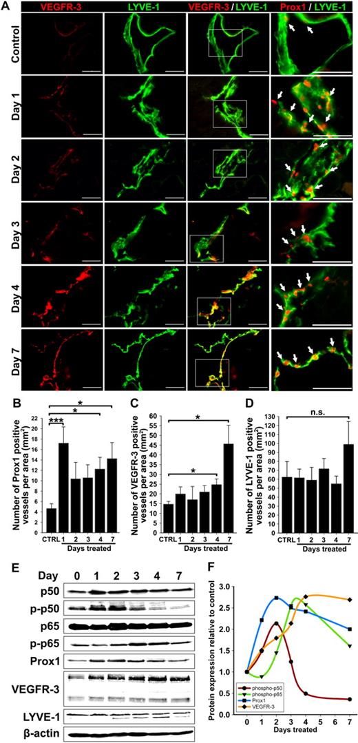 Figure 2. Up-regulation of VEGFR-3 and Prox1 precedes new lymphatic vessel formation during inflammation. (A) Double immunostaining of VEGFR-3/LYVE-1 and Prox1/LYVE-1 in serial diaphragm sections derived from mice treated with saline or TG (n = 3-4 mice per group) and harvested 1, 2, 3, 4, and 7 days after onset of treatment. Scale bars represent 50 μm. Lymphatic vessels shown are representative of whole diaphragm sections from 3 to 4 mice per group. (B-D) Quantification of Prox1-positive (B), VEGFR-3—positive (C), and LYVE-1—positive (D) vessels normalized per area of the entire diaphragm section measured in square millimeters. Quantitative analysis was performed on diaphragms harvested from 3 to 4 mice per group at indicated days after the first TG or saline injection. Data are presented as the mean number of vessels per diaphragm section ± SEM; ns denotes nonsignificant changes; *P < .05 and ***P < .01 versus control, as determined by Student unpaired t test. (E) Protein expression of Prox1, VEGFR-3, LYVE-1, NF-κB p50 phosphorylated on Ser337, nonphosphorylated NF-κB p50, NF-κB p65 phosphorylated on Ser276, nonphosphorylated NF-κB p65, and β-actin was determined by Western blot of combined lysates (100 μg of total protein per lane) derived from 3 to 4 mice per group. (F) Protein expression in Western blots was determined by band densitometry. Values were normalized to β-actin and are shown as fold increase relative to expression of corresponding proteins in untreated control mice at day 0.