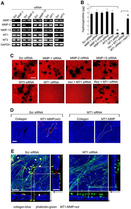 Figure 2. MT1-MMP mediates hMSC-dependent collagenolytic activity. (A) siRNA-dependent silencing of MMP expression in hMSCs as assessed by RT-PCR. hMSCs were electroporated with 40nM scrambled (Scr siRNA) or MMP-1–, MMP-2–, MMP-13–, MT1-MMP–, or MT3-MMP–specific siRNAs and cultured in growth medium for 2 days followed by RT-PCR analysis of MMP expression with GAPDH as loading control. (B-C) hMSCs electroporated with each of the respective siRNAs or cotransfected with a control expression vector (MT1siRNA + Vec) or mouse MT1-MMP expression vector (MT1siRNA + mMT1) were seeded atop Alexa Fluor 594–labeled type I collagen film (red) for 4 days and collagenolytic activity quantified by hydroxyproline release (mean ± SEM; n = 3. *P < .05) as well as visualized by confocal laser microscopy. Bar, 50 μm. (D) Cells electroporated with Scr or MT1 siRNA were incubated on Alexa Fluor 647–labeled collagen (blue) for 2 days, and cell surface was stained with anti–MT1-MMP (red). Colocalizations of MT1-MMP “dots” on the basal cell surface with areas of collagen degradation were found in Scr siRNA–treated cells. Neither MT1-MMP nor zones of degraded collagen were found in MT1 siRNA–treated cells. The position of a cell body overlying the collagen substratum is outlined by the dotted white lines. Bar, 10 μm. (E) 3D reconstructions of collagen (Alexa Fluor 647 labeling, blue), phalloidin (green), and cell surface-localized MT1-MMP (red). Black arrows mark the direction from top to bottom. White lines mark either the yellow dots (comprised of MT1-MMP–positive areas that colocalize with phalloidin), which appear in the zones of collagen degradation in Scr siRNA-cells (left), or green dots (ie, MT1-MMP–negative and phalloidin-positive), which appear atop the intact collagen surface in MT1-MMP siRNA-silenced cells (right). Bar, 10 μm.