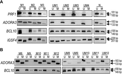 Figure 3. Validation experiments using MSP-PCR. MSP-PCR was performed for the PRF1, ADORA3, BCL10, and IGSF4 genes, using bisulfite-treated DNA from IGHV mutated samples (M1-3 to M8-12) and IGHV unmutated samples (UM1-4 and UM8-12). (A) Data for samples analyzed in the methylation array; (B) results from additional CLL samples are included. Analysis of each gene in panels A and B was performed during the same experiment and on the same gel; vertical line(s) have been inserted to indicate a repositioned gel lane. N indicates normal PBMC sample; M, methylation-specific primers; and U, unmethylation-specific primers.