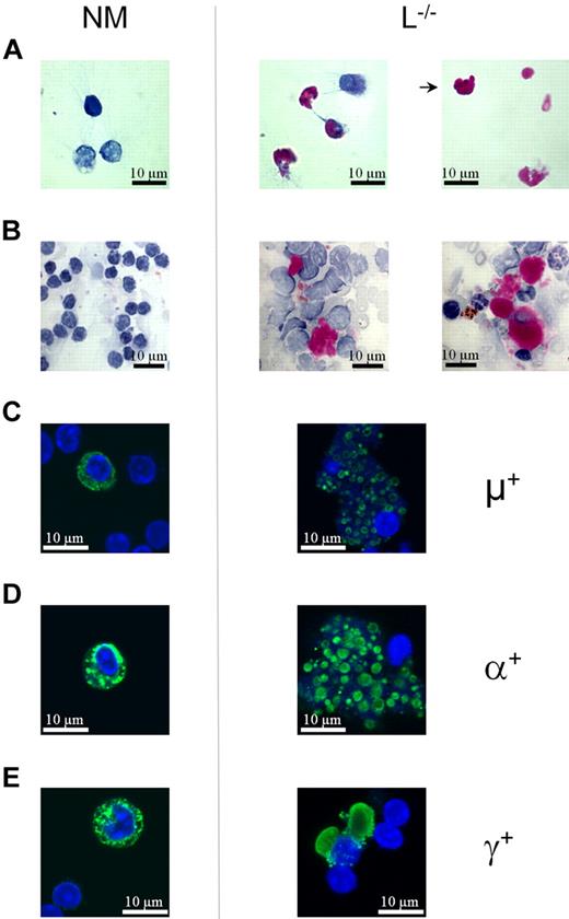 Figure 5. RB formation in L−/− plasma cells gives rise to Mott cells. (A) Sorted CD138+ spleen cells from 3-month-old normal (NM) and L−/− mice were stained with PAS, showing tightly packed glycoproteins in purple-magenta and hematoxylin-stained cell nuclei in blue. For L−/− cells, PAS staining was found either in connection with the nucleus or in isolation as spherical particles. The arrow indicates a morula cell. (B) PAS stainings of spleen cell smears from a 14-month-old L−/− and a normal aged mouse. RBs in smears, frequently surrounded by nonlymphoid cells, are larger than from sorted cells, prepared as single-cell suspensions devoid of aggregates. (C-E) Intracellular staining after fixation and permeabilization with FITC-labeled (C) anti-IgM (μ+), (D) anti-IgA (α+), and (E) anti-IgG (γ+). The DAPI counterstain shows nucleotides/dsDNA in blue. Frequencies of positive cells were < 1% for all stainings, consistent with the expected low number of plasma cells.