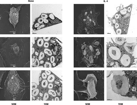 Figure 6. Microscopy analysis of zymosan phagocytosis by untreated and IL-4–treated ThioMΦs. ThioMΦs were plated on bacteriologic plastic for TEM or on coverslips for scanning electron microscopy in the same well. Cells were treated for 48 hours with IL-4 and challenged with zymosan (20 particles/MΦ) for 30 minutes at 37°C. Scanning electron microscopy showed that zymosan particles were no longer seen on the cell surface of untreated ThioMΦs, because all had been internalized by the cells (TEM data). In IL-4–treated ThioMΦs, many incomplete phagocytic cups were observed on the surface of MΦs, showing the arrest of the phagocytic cup closure (white arrows) induced by IL-4 treatment. Moreover, TEM showed that few zymosan particles were internalized in IL-4–treated ThioMΦs compared with untreated MΦs.