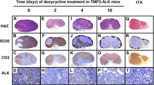 Figure 7. Histopathologic changes of lymph nodes after ALK inactivation by Dox treatment in lymph nodes of TMP3-ALK mice. The architecture of lymph node from mice with fully developed disease (day 0; A-D) is obliterated by lymphoma cells strongly positive for B220 (B). Negative area corresponds to residual T cells as seen in panel C. Lymphoma cells are positive for ALK (D). After Dox treatment (days 2-10: E-P), the lymph node progressively recovers its normal immunoarchitecture together with the decrease of ALK-positive lymphoma cells (H,L,P) and increase in normal B and T cells (M-O). Lymph node from tTA transgenic mice was used as a normal control (Q-T). Original magnification ×50 (A-C), ×40 (E-G,I-K,M-O,Q-S), and ×640 (D,H,L,P,T).