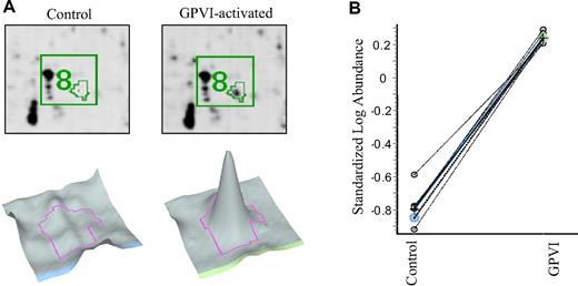 Figure 3. Example of a protein analysis of spot 8. (A) Enlarged image of 2D-DIGE showing protein spot 8. Platelets were incubated with control IgG1 (left) or HGP4C9 for GPVI activation (right) in the pH range 4.5 to 6.8. Below, corresponding 3D images of protein spot 8 are shown. (B) Graph view of spot pair 8 in 7 biologic replicates. The log standardized abundance is derived from the normalized spot volume standardized against the in-gel standard of each gel.