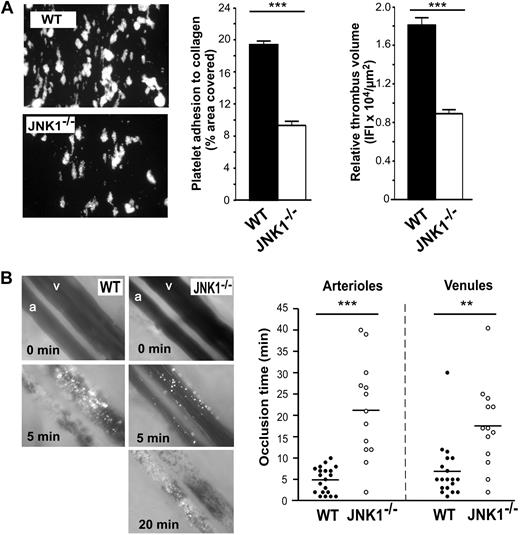 Figure 2. JNK1−/− mice display impaired thrombus formation in vitro and in vivo. The role of JNK1 in thrombus formation was investigated in vitro (A), in a whole-blood perfusion assay carried out over a fibrillar collagen matrix at a shear rate of 1500 seconds−1 and in vivo (B), in a model of arteriolar and venular thrombosis induced by photochemical damage of the cecum. (A) Whole blood from WT and JNK1−/− mice, collected in PPACK (80μM), was fluorescently labeled by incubation with rhodamine 6G (10 μg/mL) for 10 minutes, then perfused through fibrillar collagen-coated glass microcapillaries at a shear rate of 1500 seconds−1 for 90 seconds. After perfusion, the formation of thrombi was observed under an epifluorescence microscope (original magnification ×20). The mean percentage of the total area covered by platelets plus or minus SEM was calculated in 3 independent experiments, and the extent of thrombus formation was evaluated in all 3 dimensions, by calculating relative thrombus volume, measured as the IFI per μm2 of each thrombus plus or minus SEM. The statistical significance of differences between WT and JNK1−/− mice was determined in unpaired Student t tests (***P < .001). (B) Photographs show the progression of thrombus formation induced by photochemical injury to cecum arterioles (a) and venules (v) in WT and JNK1−/− mice. Calcein-AM fluorescently labeled platelets (108 platelets) were injected into the mice, with an intravenous bolus of the photoactivated dye Rose Bengal (20 mg/kg body weight). Injury to cecum arterioles and venules was induced by exposing the vessels to a wavelength of 540 nm for 30 seconds. Thrombus formation was visualized in real time using an inverted epifluorescent microscope (Nikon Eclipse TE 2000-U) using a lens at 20×/0.5 numeric aperture (Nikon). Images were acquired using a CCD CoolSNAP HQ2 camera (Photometrics/Roper Scientific) and processed with Metamorph 7.0r1 software (Universal Imaging Corporation). Vessel occlusion was defined as the stopping of blood flow for at least 1 minute. The arterioles and venules irrigating the cecum selected for analysis had diameters of 60 plus or minus 10 μm and 107 plus or minus 15 μm, respectively. The dot plot shows occlusion times for arterioles and venules as a result of photochemically induced thrombosis in WT (n = 7) and JNK1−/− (n = 6) mice. Means are indicated by horizontal lines. Statistical differences between WT and JNK1−/− mice were evaluated in 2-tailed Mann-Whitney tests (**P < .01; ***P < .001).