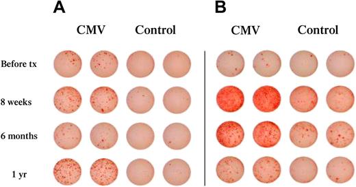 Figure 3. Development of CMV-specific T effector cells is detected in patients with or without detectable CMV viremia. Total PBLs were collected at the indicated time points after transplantation and were assessed for the presence of IFN-γ–producing effectors in response to CMV, as described in “IFN-γ ELISpot assay.” Cultures incubated with CMV lysates were scored as positive if the number of resulting spots was 3 standard deviations above the control. (A) Representative patient with detectable CMV effectors and CMV viremia. (B) Representative patient with detectable CMV effectors without detectable viremia.