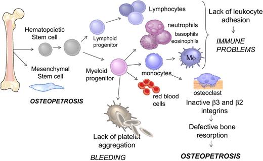 Figure 5. Schematic representation of hematopoietic and mesenchymal cell differentiation in bone marrow. Cell types affected by the loss of Kindlin-3 and the functional consequences in human subjects leading to a number of clinical manifestations, including immune defects, osteopetrosis, and bleeding.