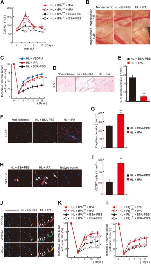 Figure 2. tPA administration accelerates revascularization in a HL ischemia model. (A) tPA or vehicle was injected intraperitoneally daily from day 0 to day 2 into tPA+/+ and tPA−/− mice after HL ischemia induction. The frequency of circulating CD45+CD11b+ cells was measured (n = 3 per group). The single dagger (†) symbol denotes a significant difference (P < .05) between day 0 and day 2 in HL tPA+/+ mice. (B) C57BL/6 mice were treated with tPA or vehicle. Macroscopic pictures of the lower limb region were taken on day 15 after HL induction. Images were acquired with 0.5× and 2.5×/0.1 numeric aperture (NA) lenses (corresponding to 5× and 25× magnification), an Olympus SZX7 camera, and Adobe Photoshop CS3. (C) The ischemic/normal blood flow ratio, determined by analysis of the whole cross-section of the limb by laser Doppler perfusion imaging analysis, is shown as a function of time. (D-G) Evaluation of necrotic areas (D-E, after 15 days; bar = 200 μm) and capillary density in sections (F-G, after 28 days; bar = 50 μm) of HL-induced mice treated with or without tPA (n = 6 per group). Panels D and F were acquired with a 20×/0.50 NA and a Carl Zeiss KS400 camera, and analyzed using Axio Vision (Carl Zeiss). (H-I) Quantification of VEGF-A+ cells (arrows) in ischemic tissues (n = 6 per group, after 15 days; bar = 20 μm). Images were acquired with a 40×/0.75 NA and a Carl Zeiss KS400 camera, and analyzed using Axio Vision (Carl Zeiss). (J) Immunohistochemical staining of VEGFR-1 and VEGF-A of ischemic muscle tissues derived from vehicle- or tPA-treated HL ischemic mice and nonischemic mice. Arrows indicate VEGFR-1+VEGF-A+ cells (bar = 20 μm). Images were acquired with a 40×/0.75 NA and a Carl Zeiss KS400 camera, and analyzed using Axio Vision (Carl Zeiss). (K-L) tPA or vehicle was injected intraperitoneally daily into tPA (K) or Plg (L) wild-type and deficient mice after induction of HL ischemia. Functional perfusion measurements of the collateral region were performed (n = 3 per group). A significant difference between tPA+/+ and tPA−/− mice treated with BSA-PBS is shown. If not otherwise mentioned, asterisks denote significant differences between BSA-PBS– and tPA-treated groups. *P < .05; **P < .001; values represent the mean ± SEM.