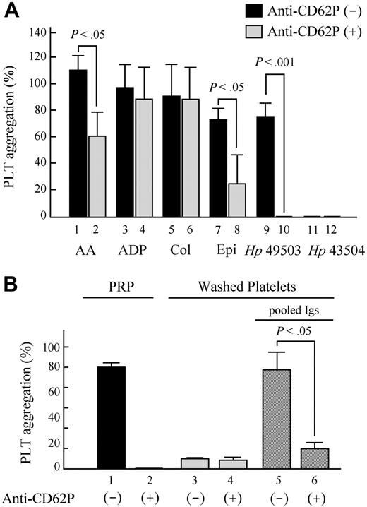 Figure 4. Anti–P-selectin antibodies completely inhibit H pylori–induced platelet aggregation. Before the addition of H pylori (platelet/bacteria ratio = 25:1) and aggregation activators, anti-CD62P antibodies were incubated with PRP for 1 minute. (A) Addition of anti-CD62P antibodies was found to inhibit aggregations induced by pro-aggregatory Hp 49503, AA, and epinephrine. PRP, washed platelets, and pooled Igs were obtained from the anti-Hp antibody-positive samples. Washed platelets were prepared by resuspending the pellets of PRP mixture in N-2-hydroxyethylpiperazine-N′-2-ethanesulfonic acid buffer and were then adjusted to the original concentration (∼ 250 000/mL). Pooled Igs purified with protein A/G beads were adjusted to the final concentration of 10 mg/mL. (B) Platelet aggregation induced by Hp 49503 was inhibited in PRP and in washed platelets with pooled Igs where anti-CD62P antibodies applied.
