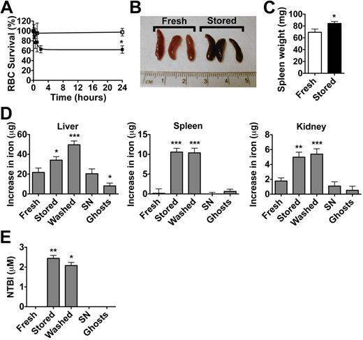 Figure 1. Transfusion of stored RBCs. Transfusions of stored RBCs lead to increased RBC clearance, tissue iron delivery, and circulating NTBI levels, compared with transfusions of fresh RBCs, stored RBC-derived supernatant, or ghosts prepared from stored RBCs. All transfusion recipients were male C57BL/6 mice (8-12 weeks of age). The results are presented as mean (± SEM) except where specified. (A) Leukoreduced fresh FVB/NJ mouse RBCs (< 24-hour storage; n = 3; □) and stored RBCs (2-week storage; n = 5; ■) were transfused (400 μL at 17.0-17.5 g/dL of hemoglobin), and survival of transfused RBCs was calculated by dual-label flow cytometric tracking at 10 minutes, 30 minutes, 1 hour, 2 hours (only for stored RBCs), and 24 hours after transfusion. The results are from 1 representative experiment and are presented as mean (± SD). (B) A representative image of spleens obtained from mice 2 hours after transfusion with fresh RBCs or stored RBCs. (C) Mean spleen weight of mice transfused with fresh RBCs (n = 13) and stored RBCs (n = 13). (D) Aliquots (400 μL) of fresh RBCs (n = 13), stored RBCs (n = 13), washed stored RBCs (n = 13), stored RBC-derived supernatant (SN; n = 12), and ghosts prepared from stored RBCs (n = 8) were transfused. Total iron was measured in organs obtained at necropsy 2 hours after transfusion; the increases in iron are shown compared with levels measured in control, untransfused mice (n = 12). The results are combined from 3 separate experiments. (E) Mice were transfused as labeled (n = 5 per group) and plasma NTBI levels were measured 2 hours after transfusion. Note that the absence of an error bar indicates undetectable NTBI levels. The results are representative of 2 separate experiments; *P < .05; **P < .01; ***P < .001 compared with fresh RBC transfusions.