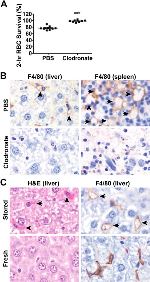 Figure 2. Macrophages are responsible for clearing transfused stored RBCs. All transfusion recipients and donors were syngeneic male C57BL/6 mice (8-12 weeks of age). (A) Mice were infused intraperitoneally with 2 mg of liposomal clodronate (n = 9) or control PBS-liposomes (n = 10) 48 hours before transfusion with stored RBCs. The 2-hour RBC survival was then measured. The 2-hour RBC survival (■) is indicated for each mouse and the horizontal bar indicates the mean. The results are representative of 2 separate experiments; ***P < .001 compared with treatment with PBS-liposomes. (B) Representative images of histologic sections of liver and spleen from mice treated with liposomal clodronate or control PBS-liposomes 48 hours before transfusion with stored RBCs, and stained with an anti–mouse F4/80 monoclonal antibody, as labeled. Note the absence of tissue macrophages in the liposomal clodronate–treated mice, as evidenced by the absence of brown staining cells. (C) Representative images of histologic sections from the liver of mice transfused with fresh or stored RBCs. Sections were stained with hematoxylin & eosin or with an anti–mouse F4/80 monoclonal antibody, as labeled. Arrows denote tissue macrophages that ingested RBCs. Brown staining is a result of F4/80 immunoreactivity of macrophages; the cytoplasmic staining is displaced to the periphery of the cells in mice transfused with stored RBCs because of the accumulation of ingested RBCs. Original magnification was ×400. Typical representative examples derived from 5 necropsies are shown.
