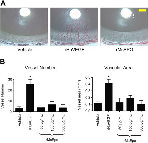 Figure 4. Mouse Epo does not stimulate angiogenesis in the rat cornea. Nylon disks coated with rMsEpo at 3 different concentrations (500, 150, or 50 μg/mL; peptide mass equivalent to 100 000, 30 000, or 10 000 U/mL rHuEpo) were implanted into the corneal stroma of rats (n = 8/group). Disks coated with vehicle (PBS + 0.1% BSA) or 420 ng/μL of rHuVEGF were used as negative and positive controls, respectively. Seven days later, the angiogenic response was evaluated from digital images of each cornea. (A) Representative images from each treatment group are shown. Scale bar in the right panel (yellow) represents 0.5 mm. (B) Quantitative measures of angiogenesis. Two vascular endpoints were evaluated: the number of blood vessels that intersect the midpoint between the disk and the limbus (left panel), and the blood vessel area (right panel). Data represent mean ± SEM. *P < .001 vs vehicle control (analysis of variance with Fisher post hoc test). Experiment was repeated with similar results.
