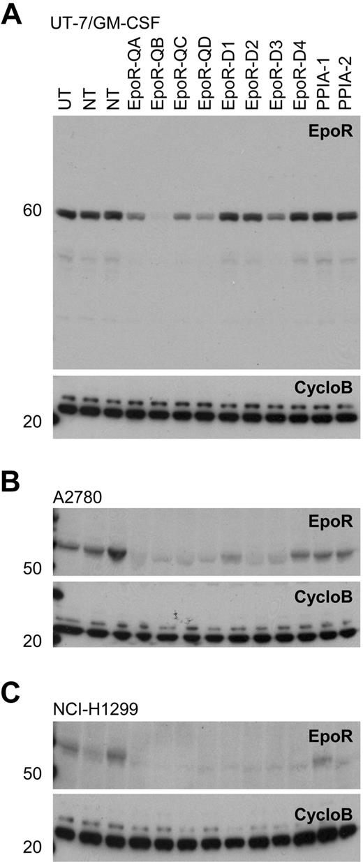 Figure 7. Western blots of EpoR knockdown for 8 different siRNAs. A82 Western blot of siRNA mediated knockdown of EPOR in transfected cells with 8 EPOR siRNAs, 2 nontargeting control siRNAs (NT), 2 cyclophilin A siRNAs (PPIA-1, PPIA-2), and an untransfected control (UT). CycloB is a loading control. Blots are representative of experiments performed on lysates from duplicate transfections on separate days. (A) UT-7/GM-CSF cells showing decreased EpoR protein in response to EPOR siRNA treatments. In the UT-7/Epo cells, there was a direct correlation between the degree of cell death observed (Figure 6) and the degree of EpoR knockdown with the 8 siRNAs (R2 = .6973; supplemental Figure 4). (B) A2780 cells and (C) NCI-H1299 cells both grown in rHuEpo show a decrease in EpoR protein in response to siRNA treatments.