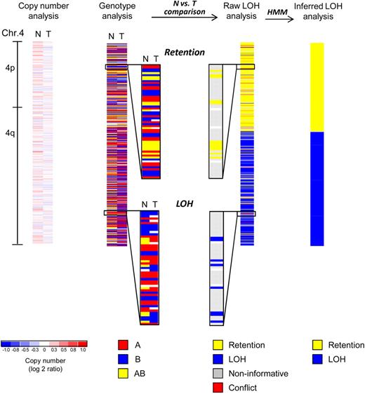 Figure 1. SNP array analysis of chromosome 4 of an MDS patient with a normal karyotype. Copy number analysis of chromosome 4 reveals no deletion or amplification in the tumor sample (T, mononuclear bone marrow). The paired normal DNA sample (N, buccal swab) is also shown. White areas indicate no copy number change (log2 ratio = zero), whereas shades of blue and red designate losses and gains, respectively (see scale at bottom). Minor fluctuations of blue and red are the result of data noise. Genotype analysis detects 3 distinct genotypes (A, red; B, blue; AB, yellow; white, no call). Comparison of normal (N) versus tumor (T) samples reveals that heterozygous calls (AB, yellow) are converted into homozygous calls (A or B, red or blue) in a distal segment of the q-arm indicating loss of heterozygosity (LOH), whereas the single nucleotide polymorphism (SNP) genotypes are retained in the proximal q-arm and the p-arm of the chromosome (retention). Raw LOH analysis is performed by computational comparison of normal-versus-tumor samples, resulting in a single column. Homozygous SNPs are noninformative in such a comparison (gray). Retention is depicted in yellow and LOH in blue. In rare instances, genotype detection errors lead to an apparent heterozygous SNP genotype in the tumor sample paired with a homozygous SNP genotype in the normal sample, and these cases are detected as conflicts (red). Note that yellow and blue have a different meaning in LOH analysis as opposed to genotype analysis (see color codes beneath each type of analysis). Hidden Markov models (HMM) are used to convert the single SNP-based raw LOH data along the chromosome into segments. Finally, inferred LOH analysis represents the last step of the genotype comparison between normal and tumor samples, revealing a copy-neutral LOH (CNLOH) of 4q in this myelodysplastic syndromes (MDS) patient.
